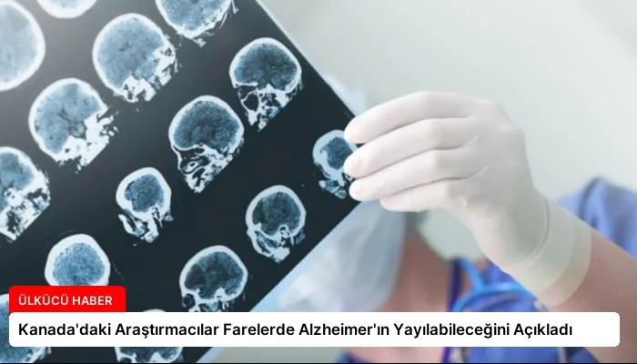 Kanada’daki Araştırmacılar Farelerde Alzheimer’ın Yayılabileceğini Açıkladı